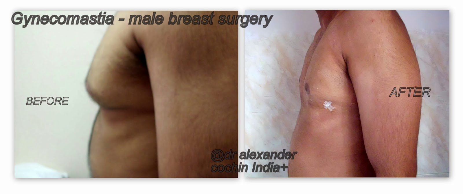 cosmetic surgeon breast Interracial mingle single